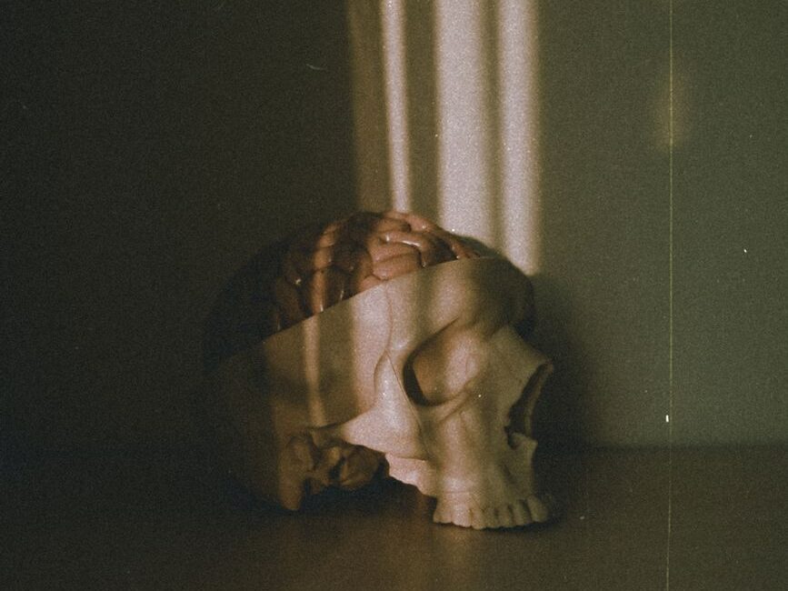 skull with brain